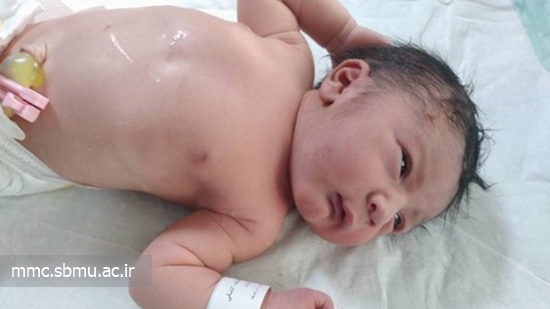 اولین نوزاد متولد شده در مرکز مهدیه بعد از تحویل سال 